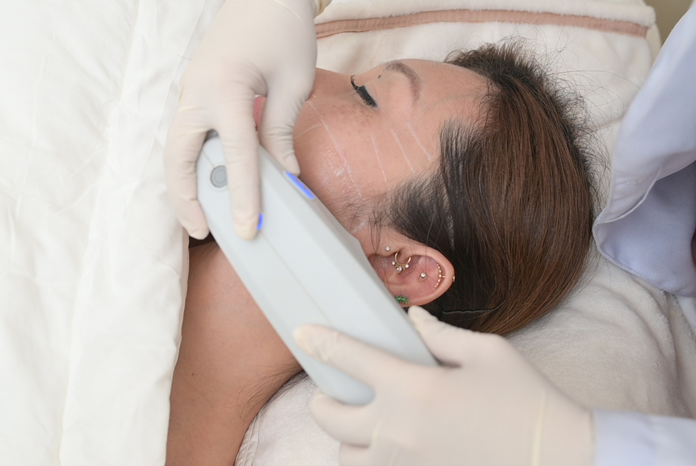 Luminisce’s Ultheraphy