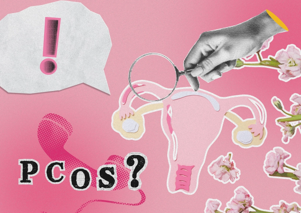 PCOS Polycystic Ovary Syndrome